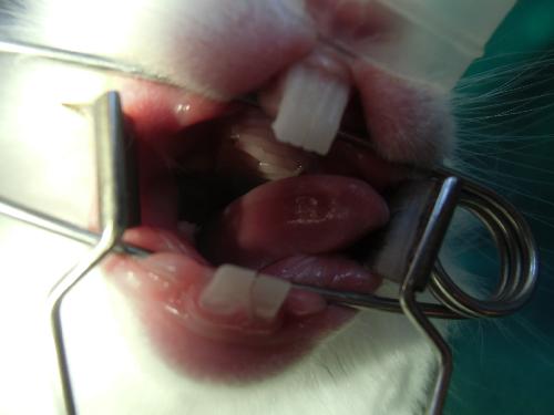 臼歯３